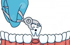 天津河西区诺尔口腔种植牙怎么样？多少钱？项目评价和价格构成都能看到