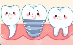 茂名致美口腔种植牙怎么样？多少钱？带你看清一颗牙背后的费用构成