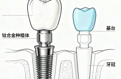 霸州中科口腔种植牙怎么样？多少钱？种植牙口碑和价格参考一起盘点