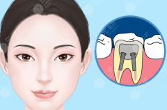 惠州皓齿口腔种植牙怎么样？多少钱？一颗牙背后包含哪些费用