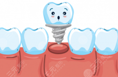 邢台市美植口腔种植牙怎么样？多少钱？从口碑到价格，帮你提前做好功课