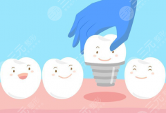 平湖市麦芽口腔种植牙怎么样？多少钱？机构实力、种植技术和价格参考一篇看懂