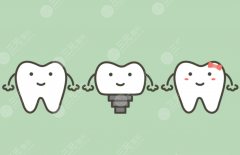 张家港市鼎植口腔种植牙怎么样？多少钱？？单颗种牙费用与医院实力全解析