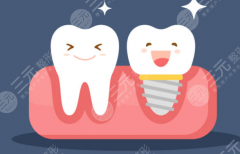 上海亿大口腔种植牙怎么样？多少钱？机构实力、种植技术和费用情况深度解析