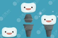 成都锦江极光口腔种植牙怎么样？多少钱？看口碑、比价格、再决定也不迟