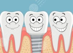 烟台博仕美奥口腔种植牙怎么样？多少钱？核心实力实测，靠谱度拉满