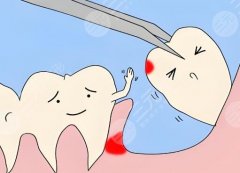 汕头汕美医疗美容种植牙怎么样？多少钱？汕头本地种牙可以看看这