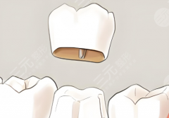 上海薇琳伯曼口腔种植牙怎么样？多少钱？盘点医院的优势，小白必看