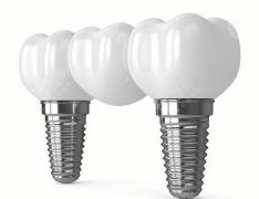 汉中护齿博士口腔医院种植牙怎么样？多少钱？看完这篇心里门儿清