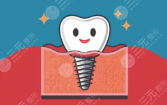 太原中诺口腔医院种植牙怎么样？多少钱？单颗收费、医生实力与口碑一文看懂