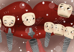 湖南岳雅口腔种植牙怎么样？多少钱？技术亮点与价格详情一文了解