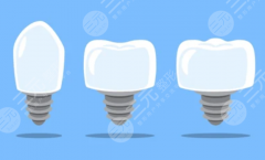 佛山鼎植金铂口腔种植牙怎么样？多少钱？从口碑到费用帮你一次看明白