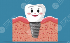 株洲中诺口腔医院种植牙怎么样？多少钱？单颗价格、医生实力与口碑详细盘点