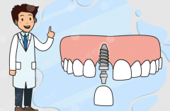 遵义汇川齿度口腔种植牙怎么样？多少钱？从实力到费用全面解析