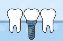 昭通西南博大口腔种植牙怎么样？多少钱？从收费到效果，这篇帮你提前摸清