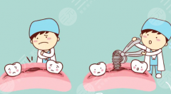 昆山云舒口腔种植牙怎么样?多少钱?价格是否透明、口碑如何详细解析 昆山云舒口腔种植牙怎么样?多少钱?价格是否透明、口碑如何详细解析