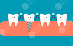 西安莲湖圣贝口腔种植牙怎么样？多少钱？先了解价格和技术再决定