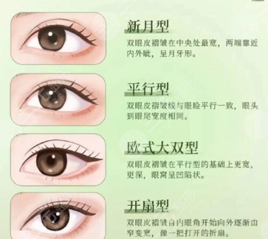 双眼皮