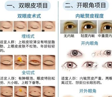 双眼皮