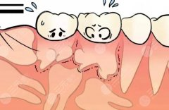 济宁附属医院口腔颌面外科医生名单一览！郑海英/朱学芬技术靠谱！