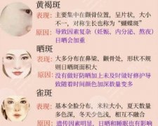 大同五医院祛斑怎么样？医院信息|擅长项目|价格公布！