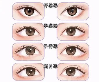 双眼皮