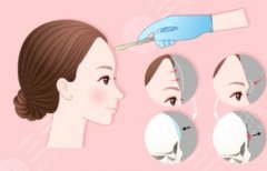 常熟第一人民医院脂肪填充费用表出炉！热门项目收费明细请查收