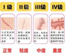 泰州第四人民医院点阵激光价格表更新！费用低至3k左右！