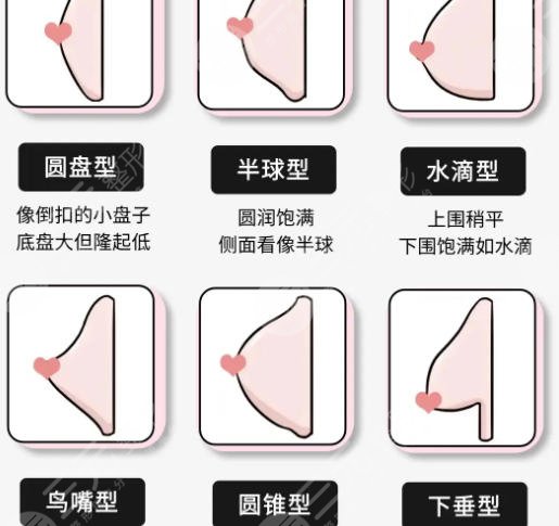 隆胸