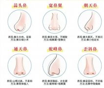 江西省妇幼保健院假体隆鼻多少钱？2026价格表全新发布！