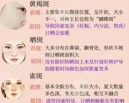祛斑