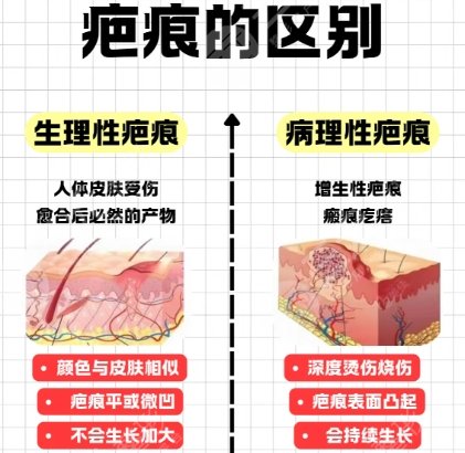 祛疤