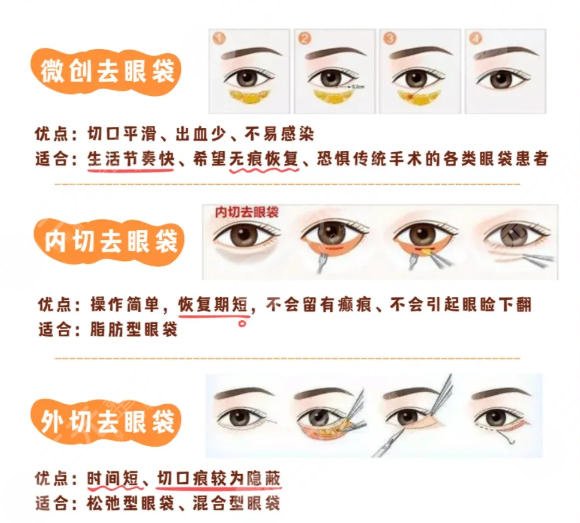 去眼袋