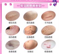 青医附院医学美容中心去疤的大夫有哪些？蔡霞、冷向锋口碑不错！