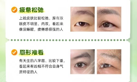 开眼角