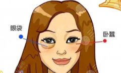 徐州做眼袋手术在哪家医院好？本地靠谱机构筛选，速看