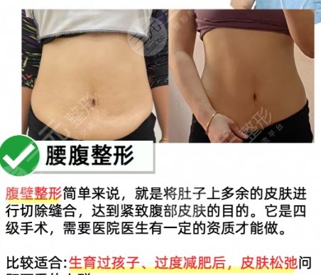 吸脂