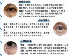 青医附院祛眼袋挂什么科？科室信息及项目收费细节等你来看！