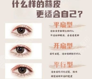 双眼皮