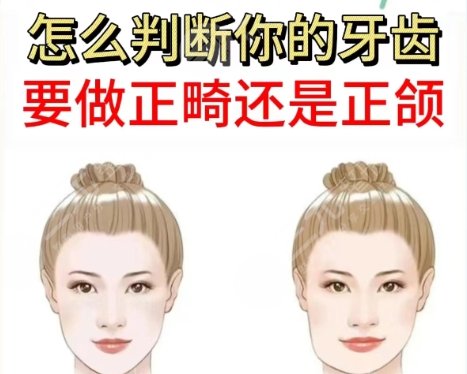 正颌