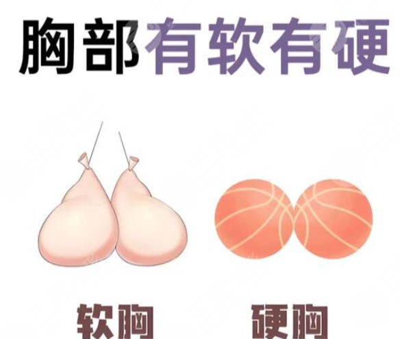 隆胸