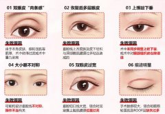 青医附院整形科价格贵不贵？全切双眼皮1万起、假体隆鼻2万3起