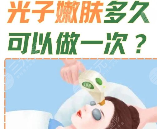 光子嫩肤