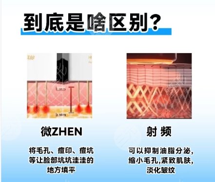 点阵激光