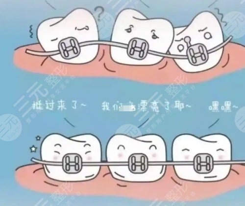 牙齿矫正