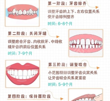 牙齿矫正