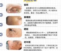 杭州新华医院点阵激光怎么样？专业团队|技术优势剖析！