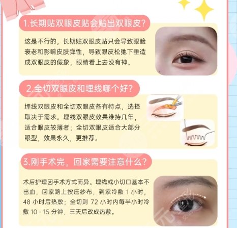 双眼皮