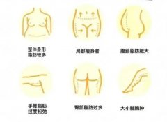 山西医科大学第一医院抽脂多少钱？2026价格明细公布！抽脂3万1左右起