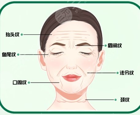 除皱